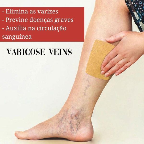 PARCHES PARA VARICES