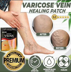 PARCHES PARA VARICES