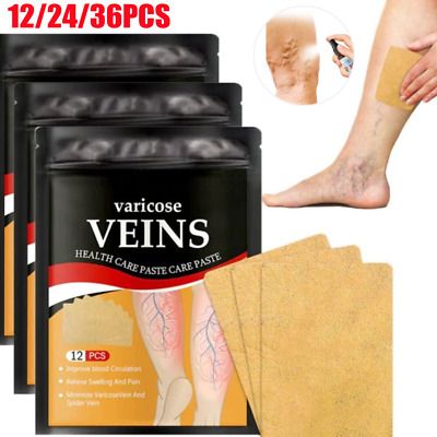 PARCHES PARA VARICES